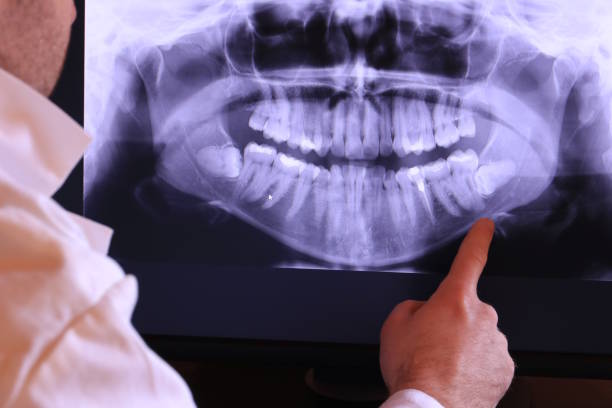 Best Emergency Treatment for Jaw Pain or Injury in Blythewood, SC